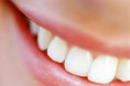 Dentística e Estética